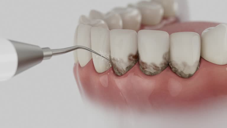 Reliable Dental Implants contractor in Breese, IL by Smile Center Dentistry